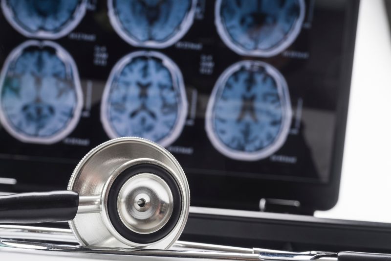 De fondo, unas pruebas médicas.